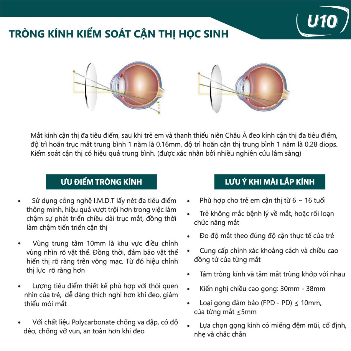 Tròng Kiểm Soát Cận Thị Học Sinh - Chemi Myopia Control Lens - Ảnh 4